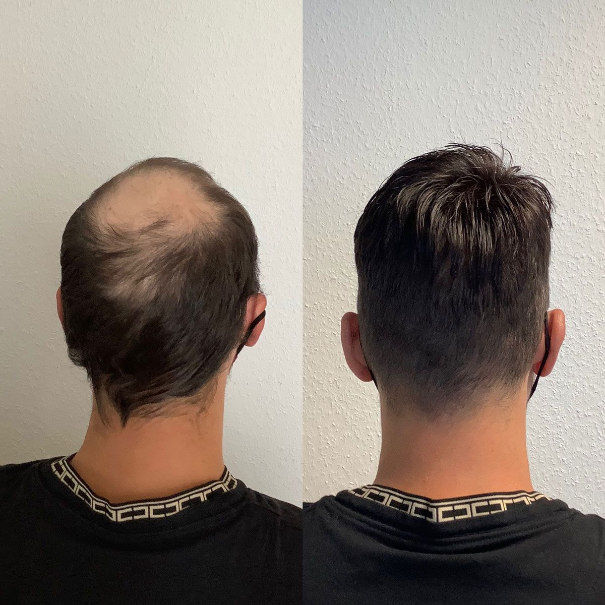 Männer Haare behandeln